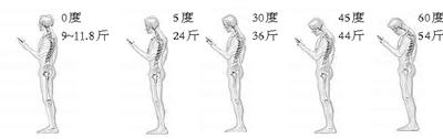 低頭看手機，脖子負(fù)重50斤